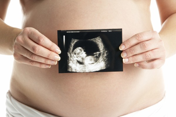 detail der schwangeren frauen holding ultraschall