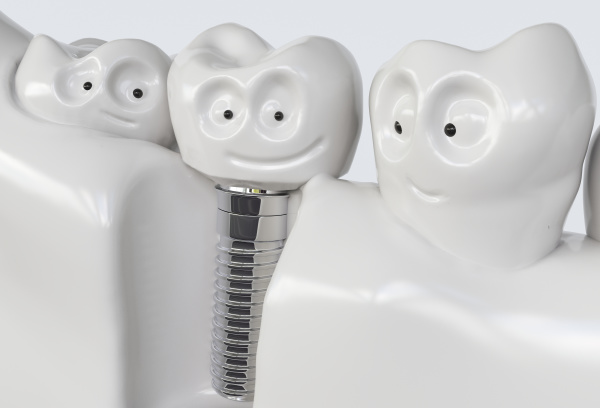 tooth human cartoon implant