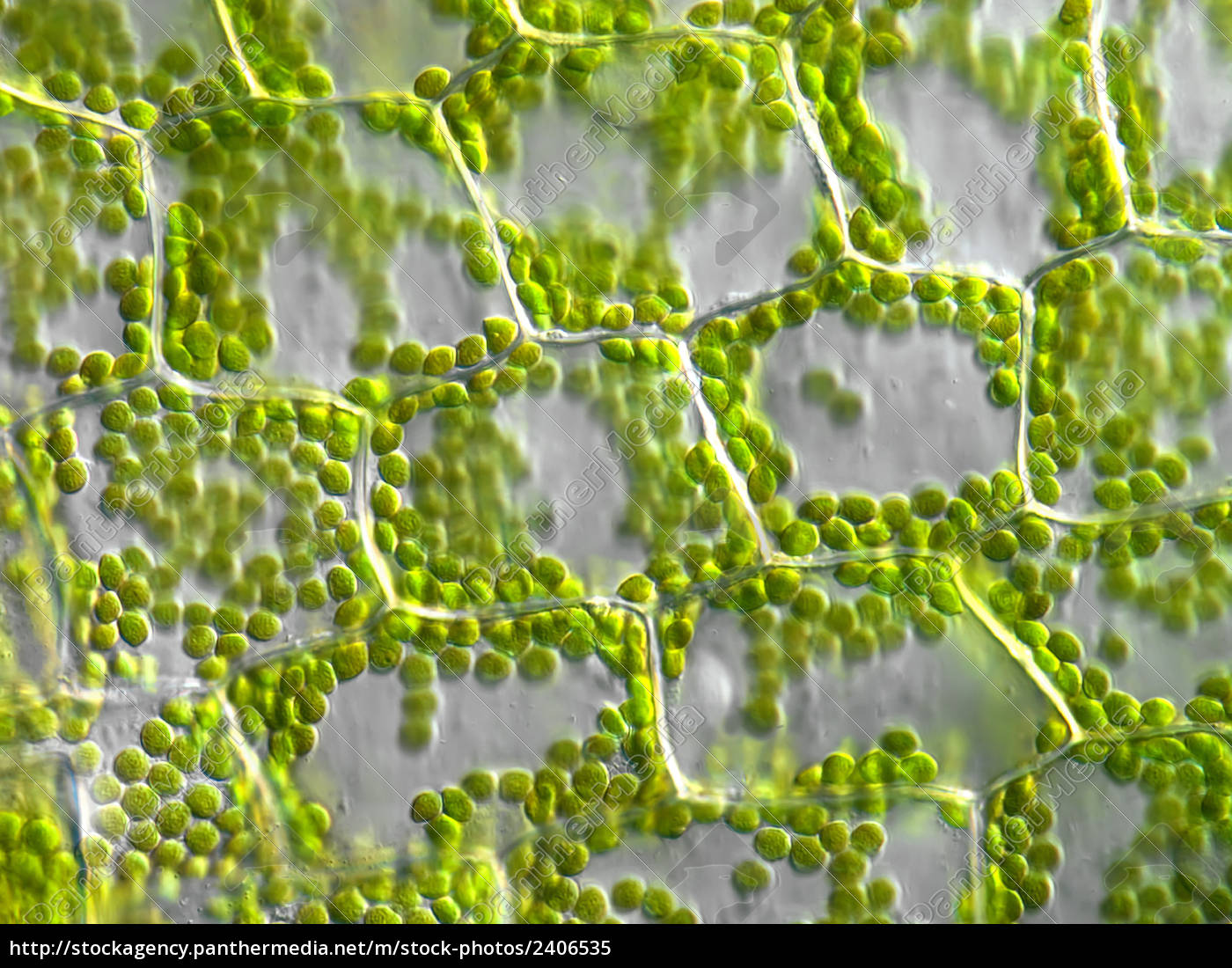 Pflanzenzellen Mit Chloroplasten Mikroskopisch Lizenzfreies Bild 2406535 Bildagentur Panthermedia