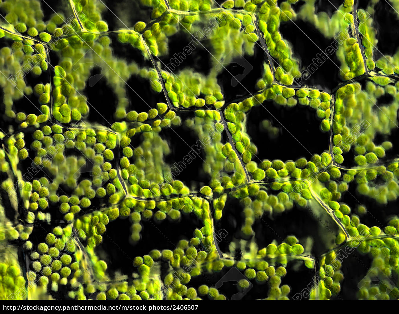  Pflanzenzellen  mit Chloroplasten mikroskopisch Stockfoto 