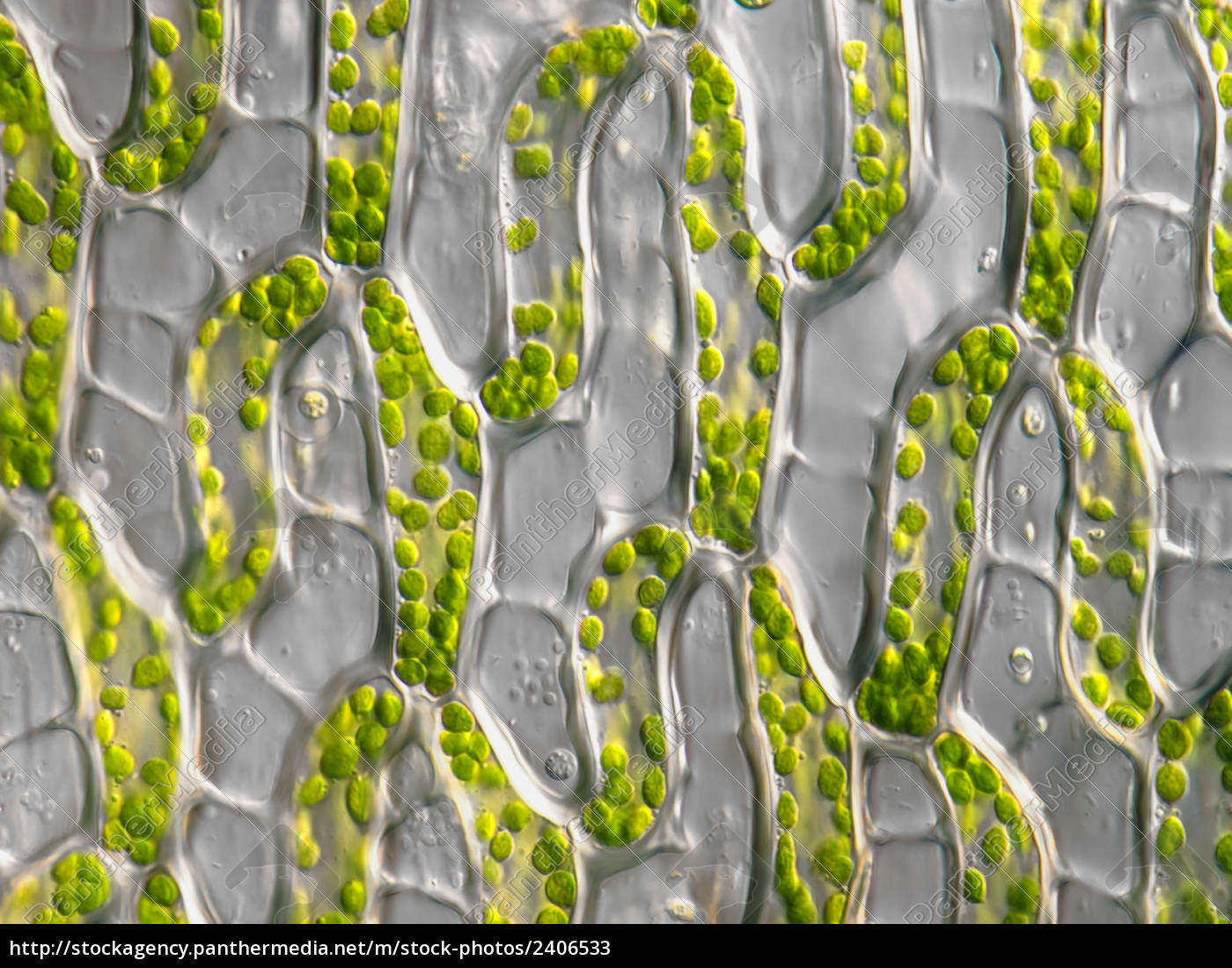  Pflanzenzellen  mit Chloroplasten mikroskopisch 